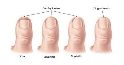 Evde Tırnak Çekme Hizmeti